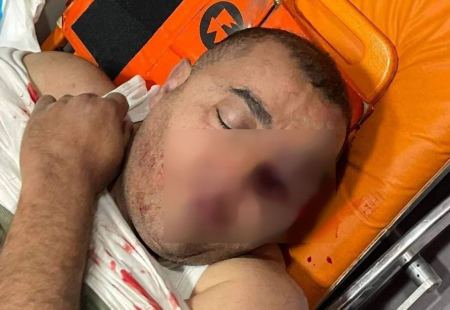 القدس : عشرات الاصابات خلال تشييع جثمان الشهيد وليد الشريف